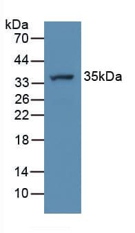ATP6AP2 / Renin Receptor Antibody (aa18-302)