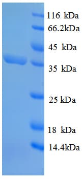 E. coli Dihydrodipicolinate Synthase Protein (Recombinant His)