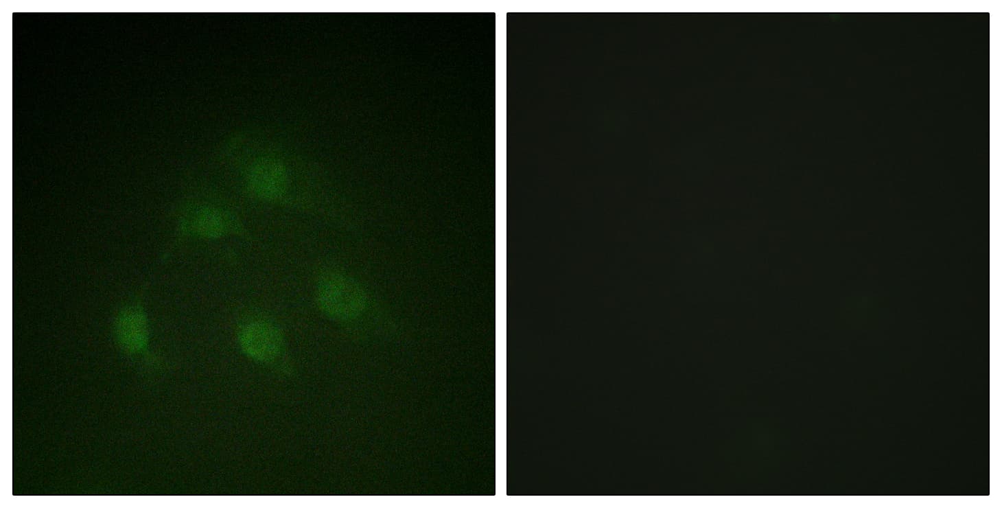 IHC-plus™ SMAD1 Antibody (aa153-202)