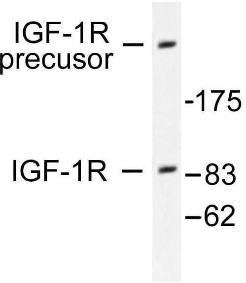 IGF1R / IGF1 Receptor Antibody (Gly1155)
