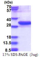 Human UBE2Z / USE1 Protein (Recombinant His)