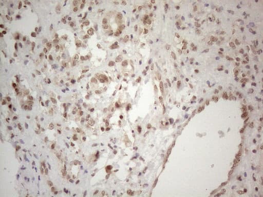 WTAP Antibody (aa2-106, clone OTI6H3)