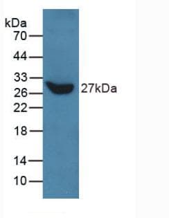 TLN1 / Talin 1 Antibody (aa975-1181)