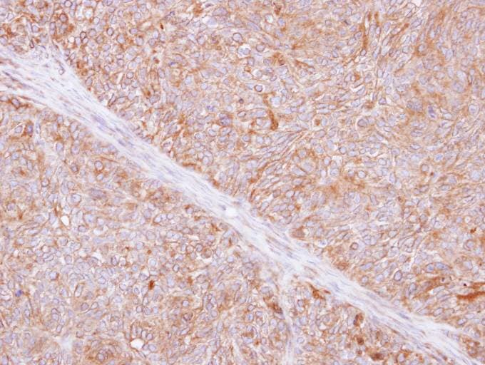 TMED9 Antibody (aa1-230)