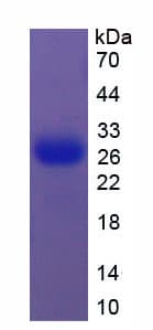 Mouse CLU / Clusterin Protein (Recombinant His)