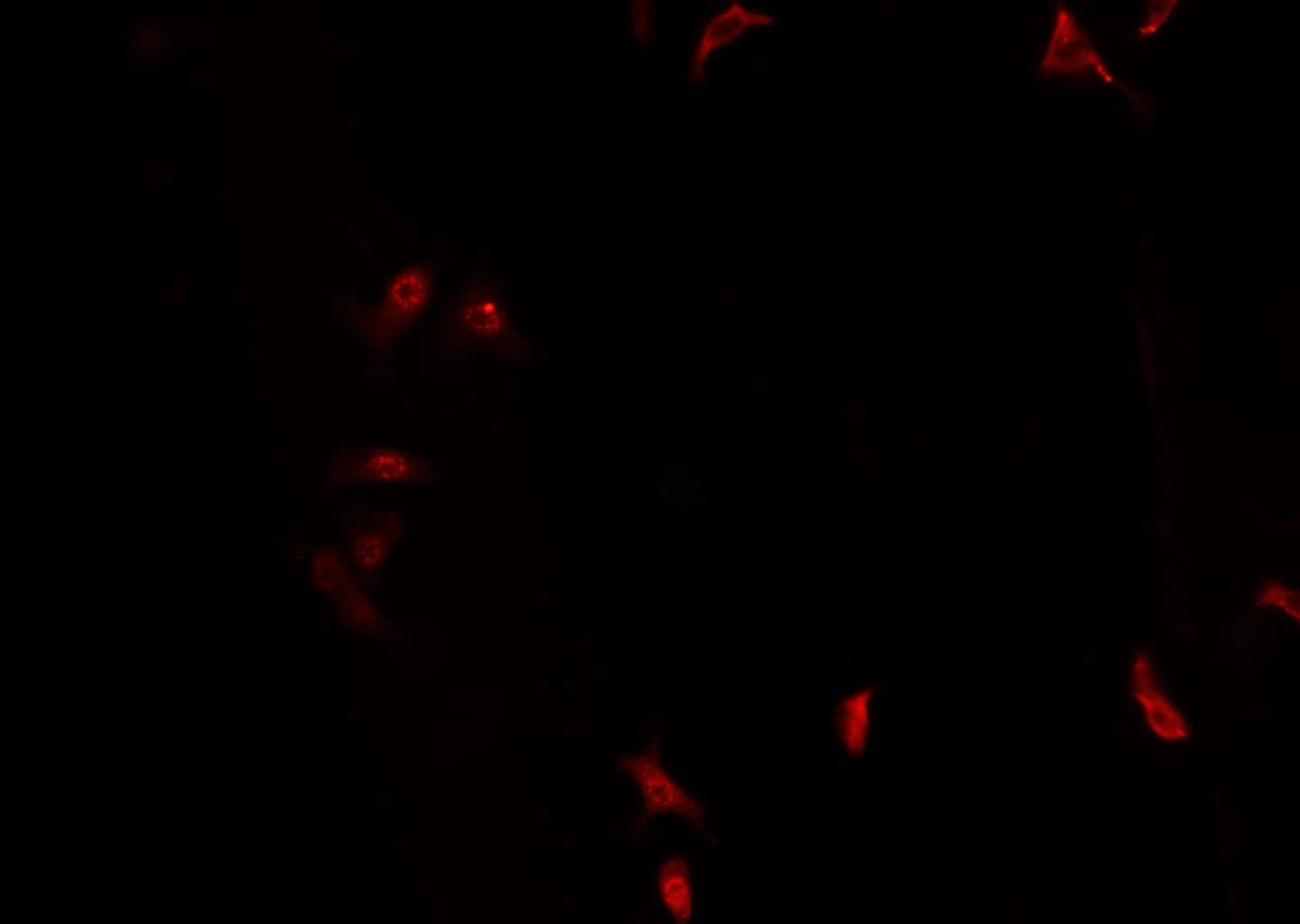 Polyclonal Rabbit anti-Human PIN1 Antibody (IF, WB)