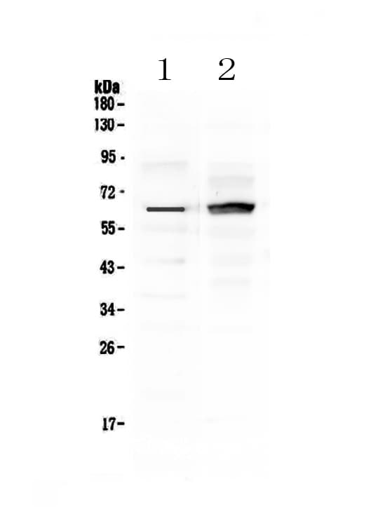 FZD4 / Frizzled 4 Antibody