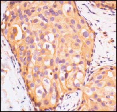 IGF1R / IGF1 Receptor Antibody (C-Terminus)