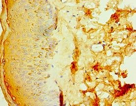 IL20RB Antibody (aa48-177)