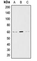 AKT1 + AKT2 + AKT3 Antibody (C-Terminus)