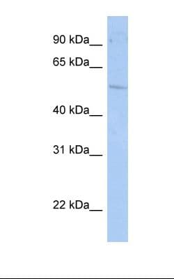 Polyclonal Rabbit anti-Human RORC / ROR Gamma Antibody (aa110-159, IHC, WB)