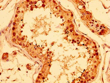 ERI1 / HEXO Antibody