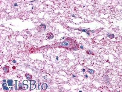 PathPlus™ MRGPRF Antibody (N-Terminus)
