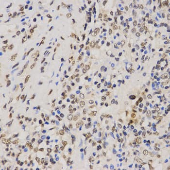 Histone H3 Antibody (Tri-Methyl-Lys79)