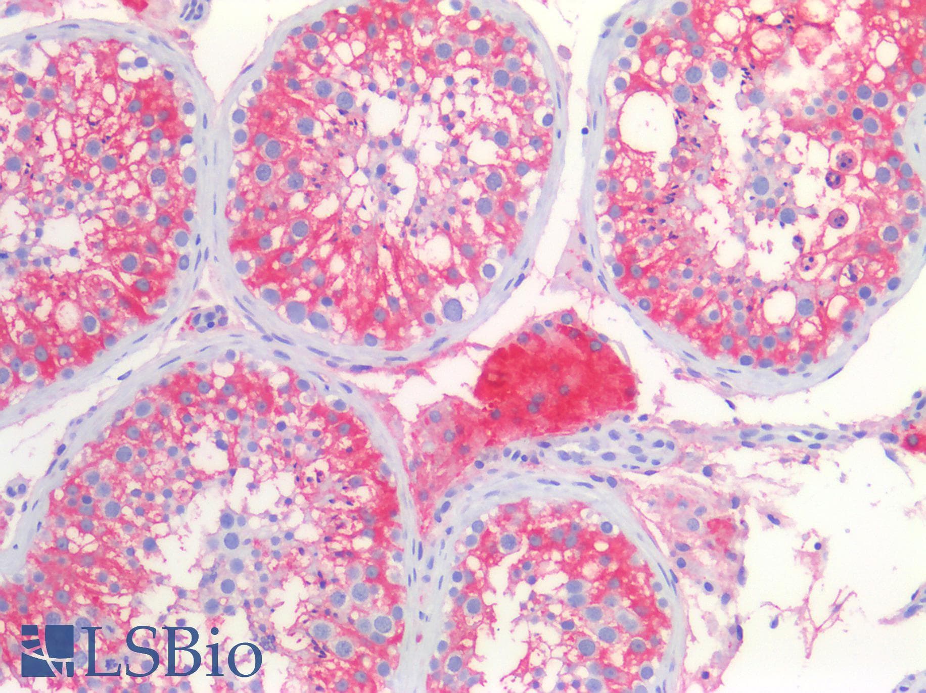 PathPlus™ MVP / VAULT1 Antibody (clone 2H3-1A6)