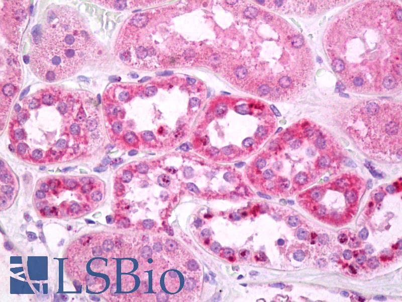 IHC-plus™ SLC6A11 / GAT-3 Antibody (C-Terminus)