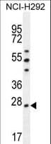 PRDX4 / Peroxiredoxin 4 Antibody (aa82-110)