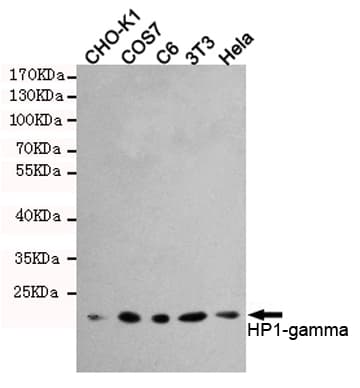 PathPlus™ Monoclonal Mouse anti-Human CBX3 / HP1 Gamma Antibody (IHC, WB)