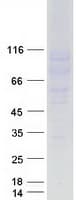 Human CD22 Protein (Recombinant Myc-DDK (Flag))