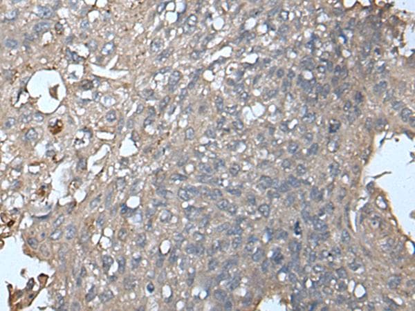 UNC13B Antibody