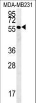 Polyclonal Rabbit anti-Human RAB11FIP2 / Rab11-FIP2 Antibody (aa345-374, IHC, WB)