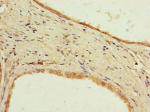 Polyclonal Rabbit anti-Human PPP2R2D Antibody (IHC, IF, WB)