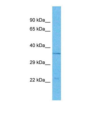 OR5B17 Antibody (aa203-252)