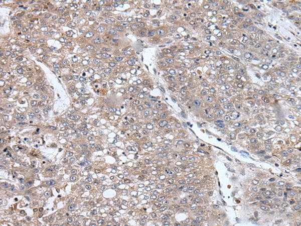 Polyclonal Rabbit anti-Human C13orf34 / BORA Antibody (IHC, WB)