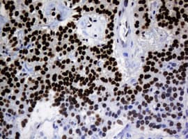 ZSCAN18 / ZNF447 Antibody (clone OTI4D10, Carrier-free)