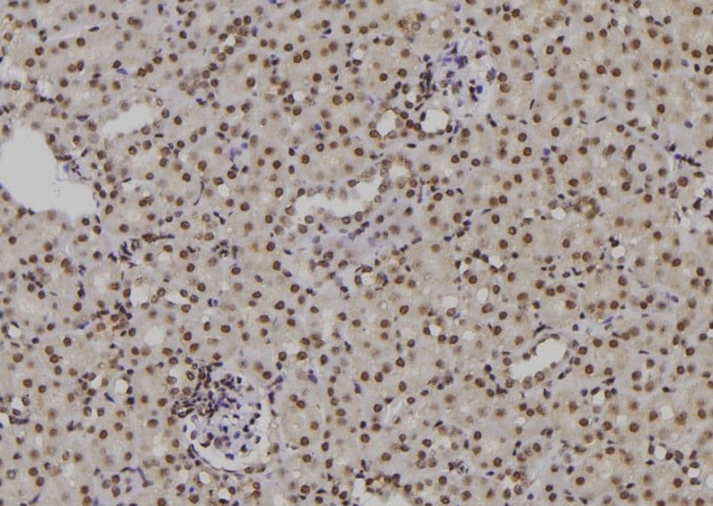 POLH / DNA Polymerase Eta Antibody