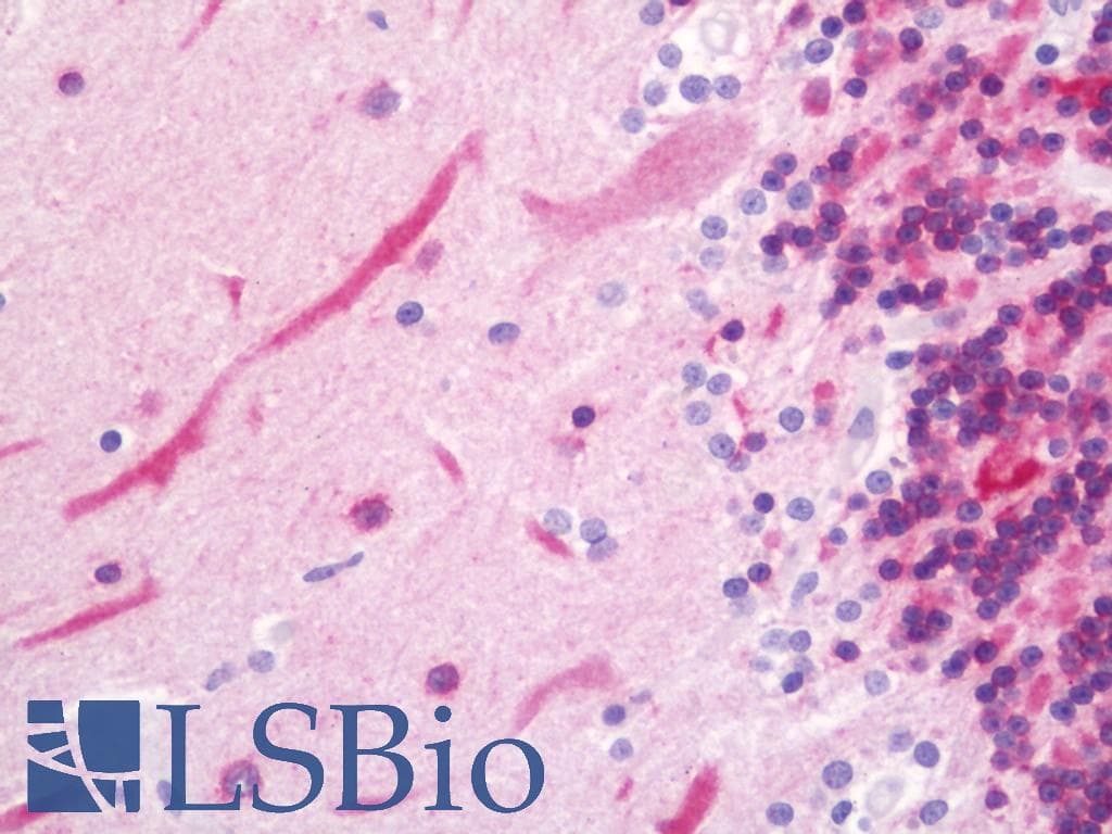 IHC-plus™ Polyclonal Rabbit anti-Human PTGIR / IP Receptor Antibody (aa188-237, IHC, WB)