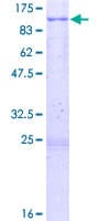 Human PLK3 Protein (Recombinant GST)