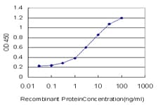 FOXO3 / FOXO3A Antibody (clone 1D2)