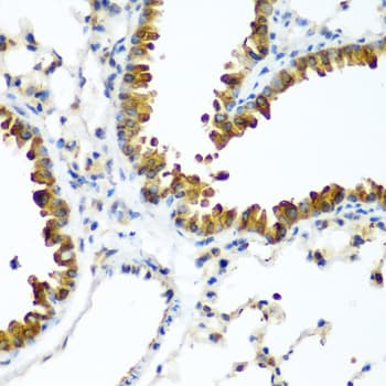 IHC-plus™ WWTR1 / TAZ Antibody