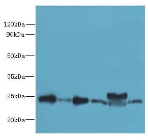 RPL10L Antibody