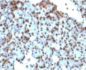 SUMO1 / SMT3 Antibody (clone S1MT-2)