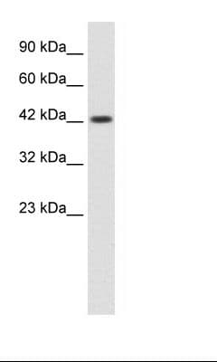 Polyclonal Rabbit anti-Human ZP3 Antibody (C-Terminus, WB)