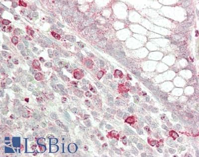 IHC-plus™ PSAP / Prosaposin Antibody (aa291-340)