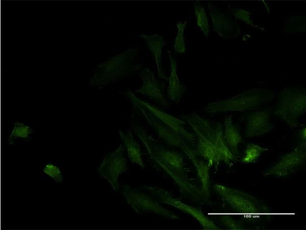 Monoclonal Mouse anti-Human ODF2 Antibody (clone 1A1, IF, WB)