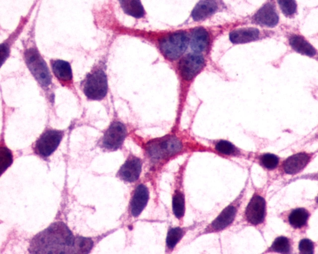 PathPlus™ GRM3 / MGLUR3 Antibody (N-Terminus)