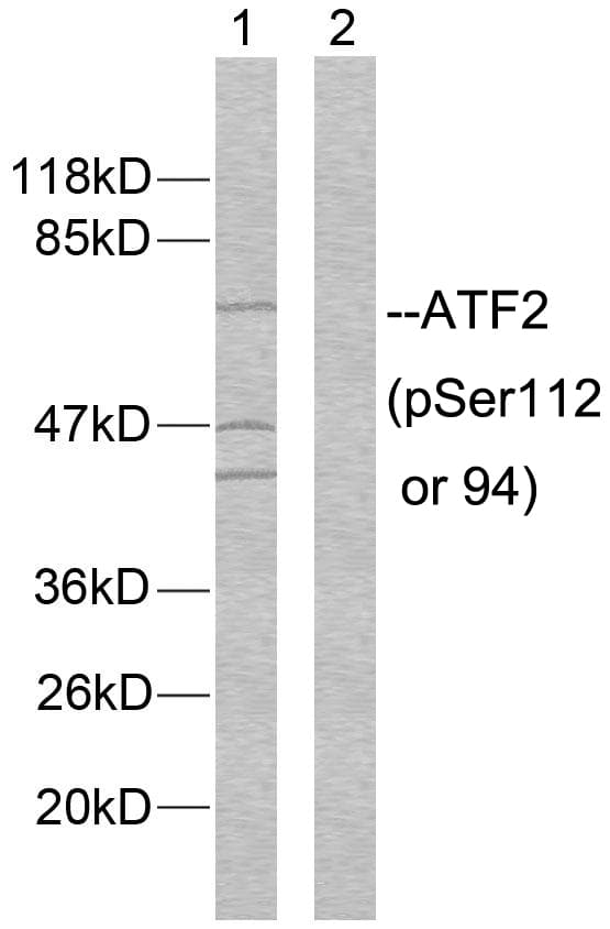 ATF2 Antibody (phospho-Ser112)