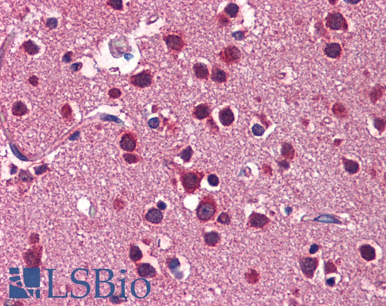 LSM1 Antibody (C-Terminus)