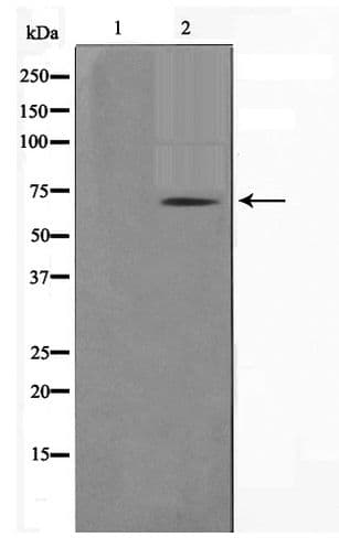 GAD1 + GAD2 Antibody