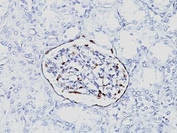 WT1 / Wilms Tumor 1 Antibody (aa1-181, clone 6F-H2, Ready-to-Use)