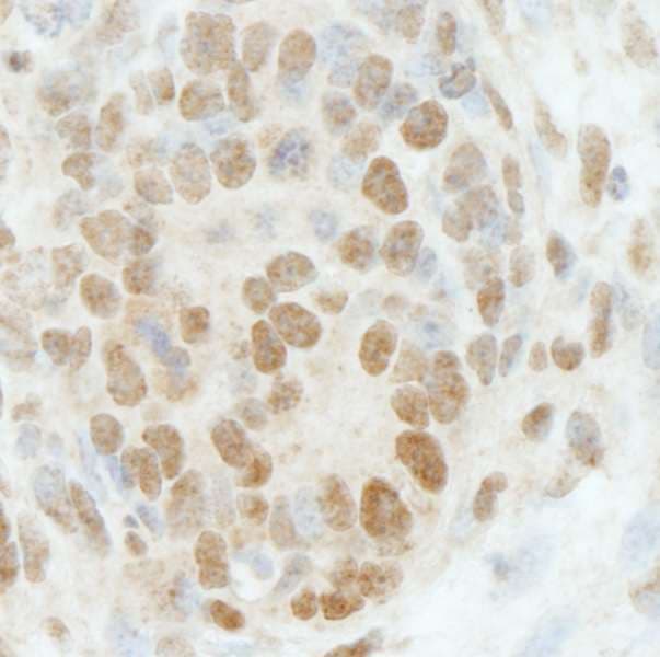 Polyclonal Rabbit anti-Human RBBP5 Antibody (aa500-C-term, IHC)