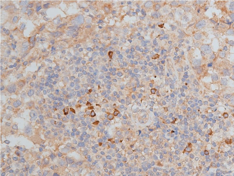 Polyclonal Rabbit anti-Human MMP9 / Gelatinase B Antibody (IHC, IF, WB)