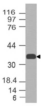 CCR2 Antibody
