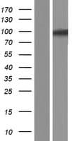 USP6NL Protein (Over-Expression Lysate Myc-DDK (Flag))