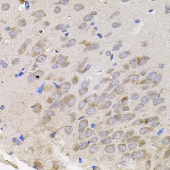 TNF Alpha Antibody