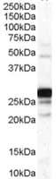 IHC-plus™ Polyclonal Goat anti-Human COMT Antibody (aa170-183, IHC, WB)